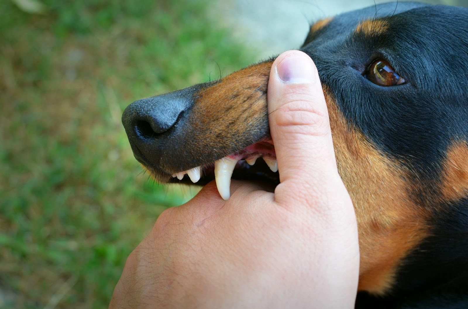 Close-up of a dog's jaws biting a human hand, illustrating a dog bite injury.