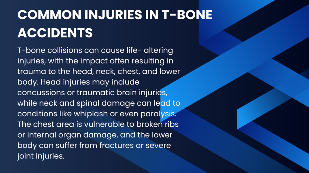 An infographic illustrating common passenger injuries in T-bone accidents in Alabama.