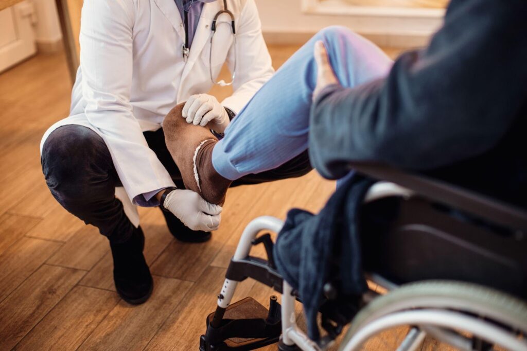 A doctor wearing gloves examines the leg of a senior patient in a wheelchair, assessing issues related to amputation and loss of limb function.